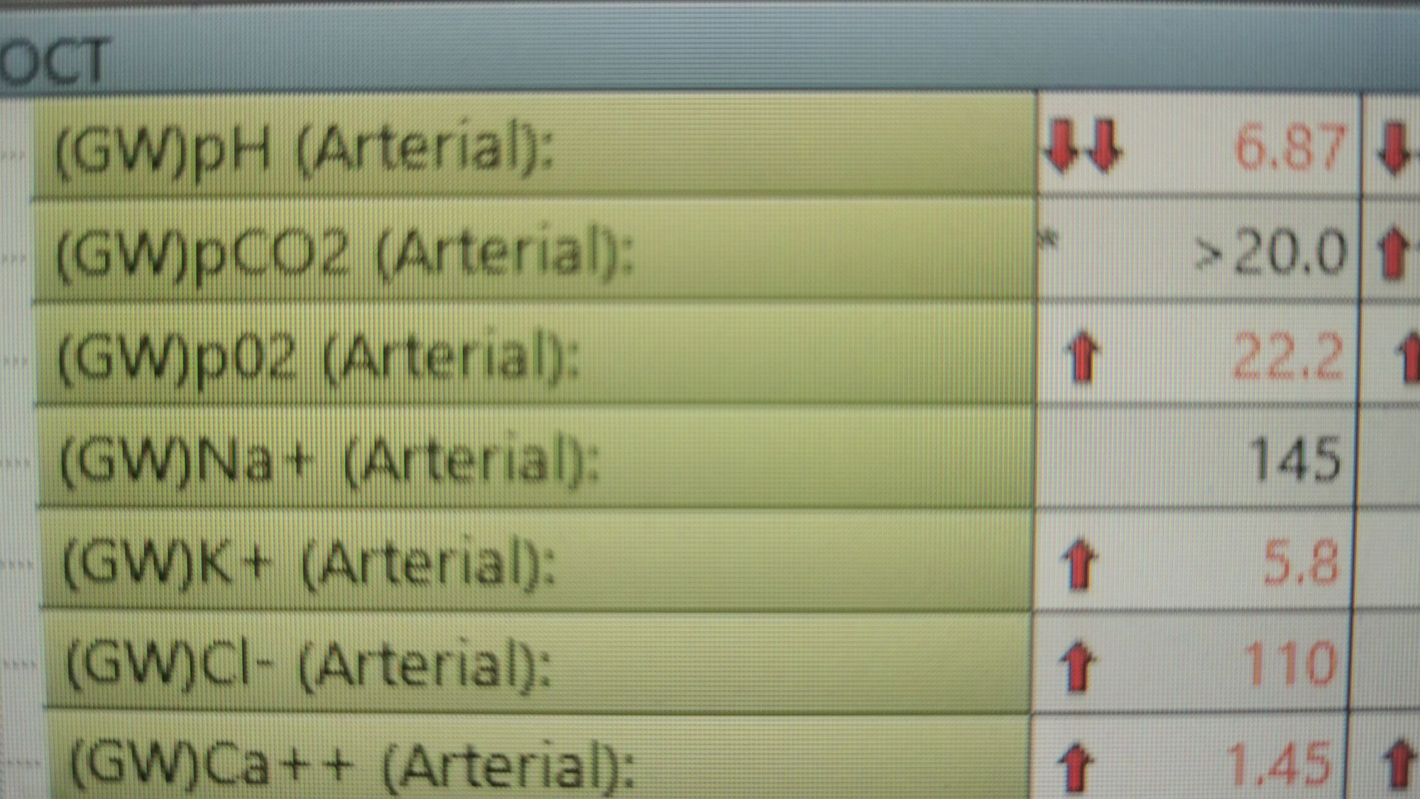 Type I vs Type II Respiratory Failure