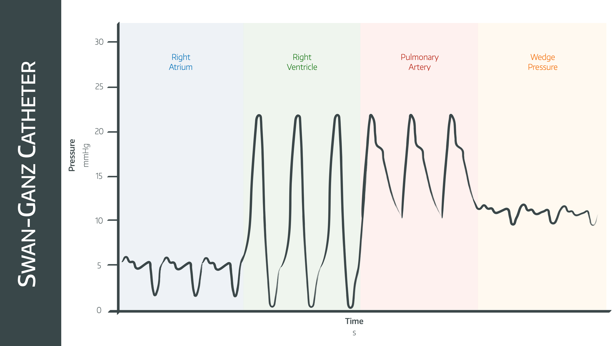 Pressure Waveforms and Cardiac Output