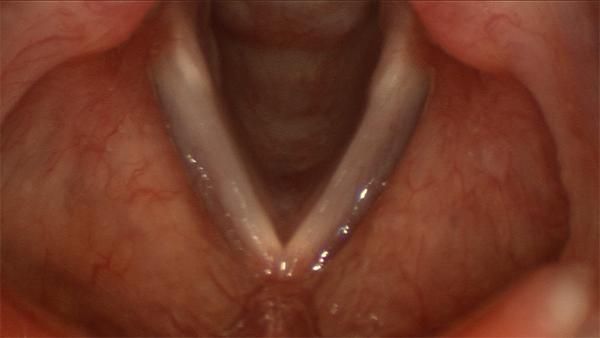 Airway Assessment