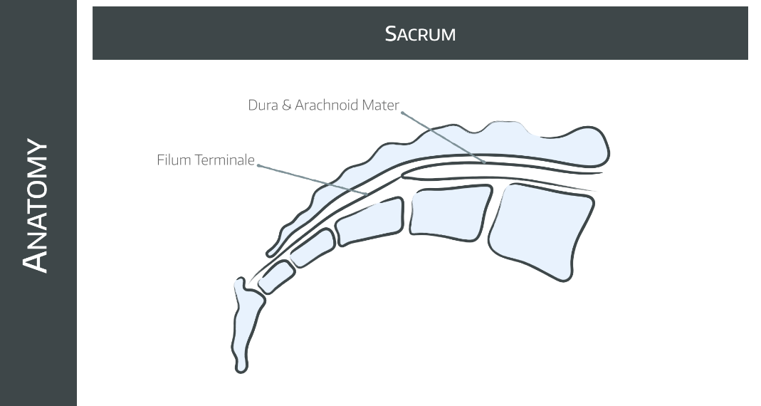 Caudal Anaesthesia