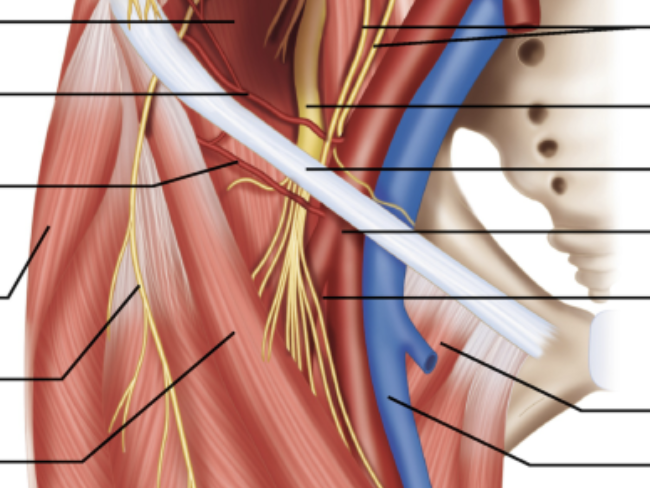 Femoral Nerve Block